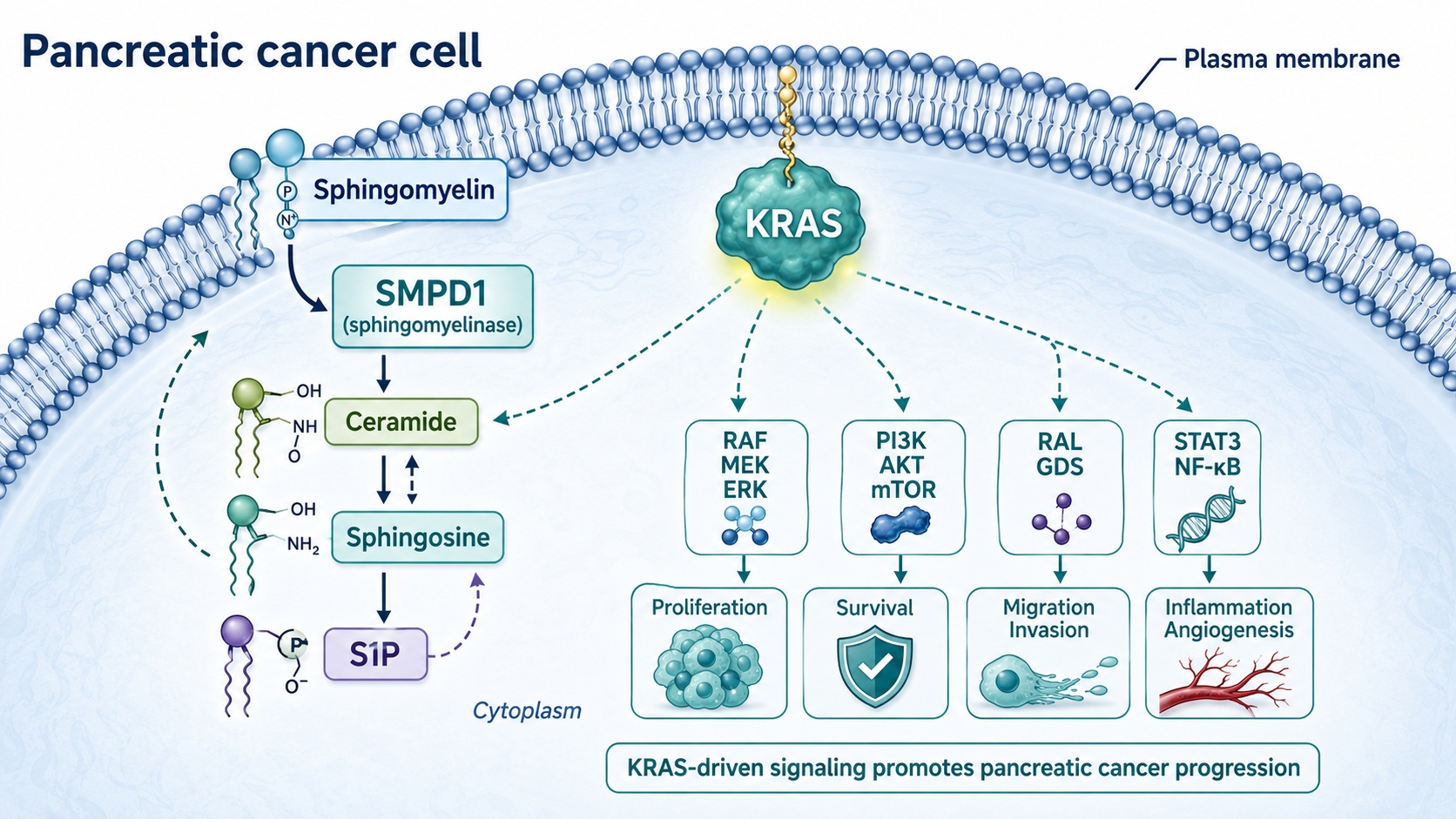 Sphingolipid Metabolism and KRAS in Pancreatic Cancer: A New Translational Signal