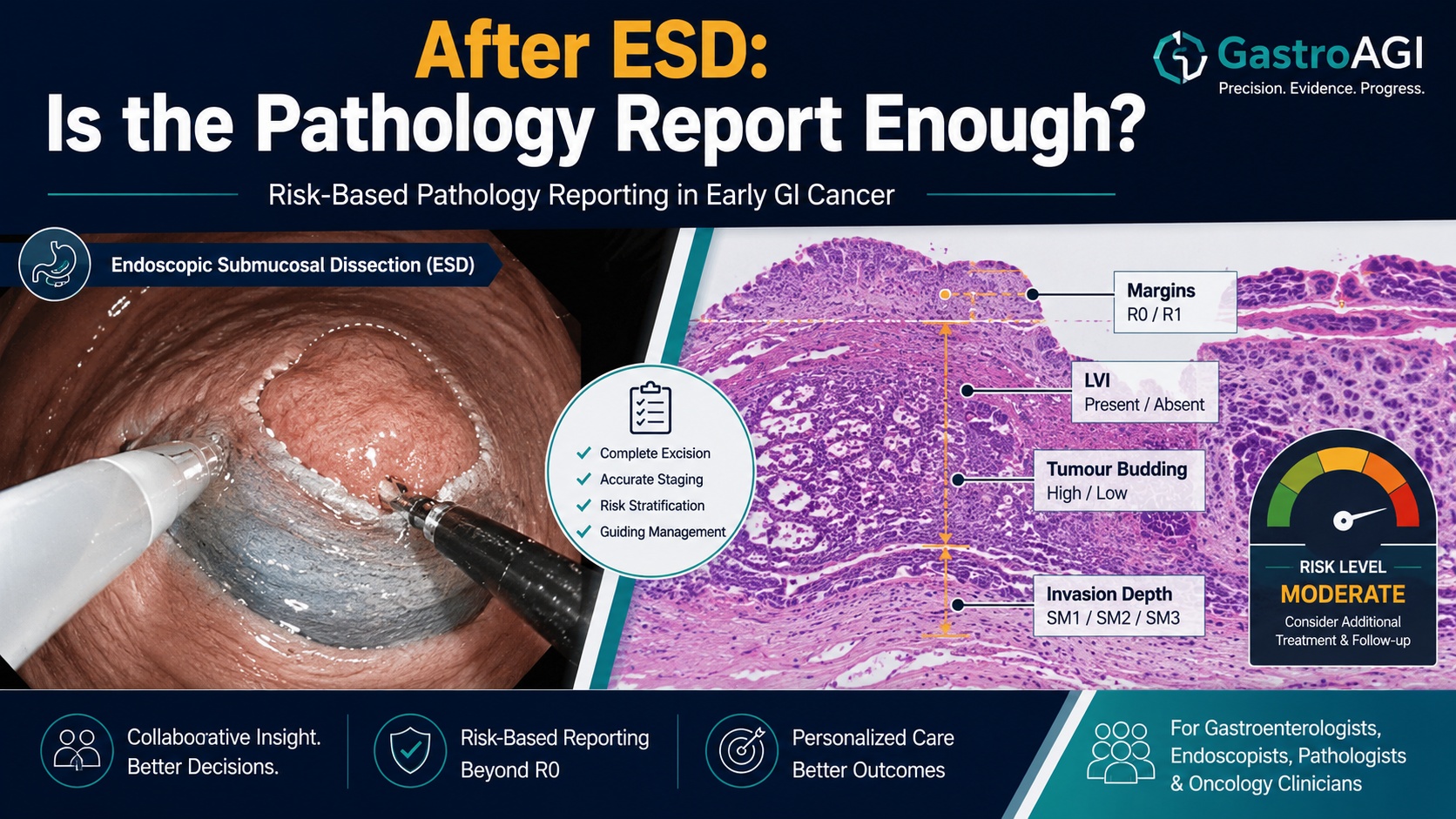 Risk-Based Pathology Reporting After ESD for Early GI Cancer: Why Standardisation Matters